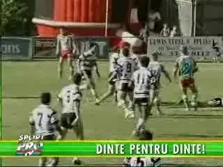 Un rugbyst a trait 4 luni cu dintele unui adversar infipt in arcada