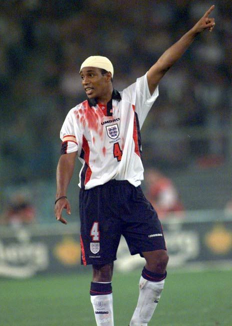 Ei chiar si-au dat sangele pentru fotbal! Vezi cei mai RUPTI jucatori din Anglia_4