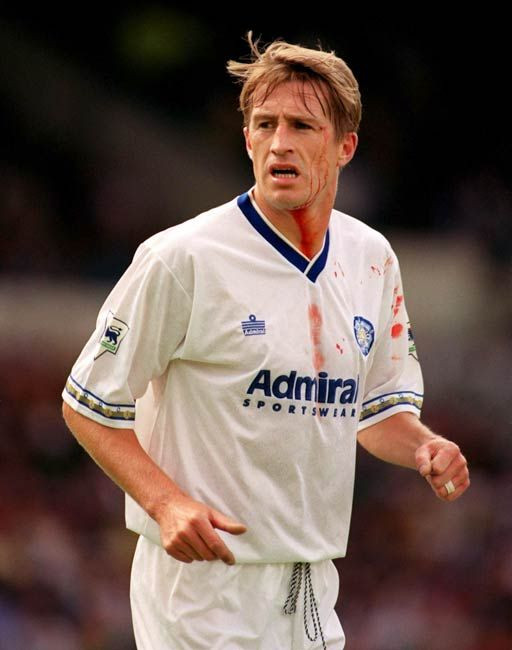 Ei chiar si-au dat sangele pentru fotbal! Vezi cei mai RUPTI jucatori din Anglia_6