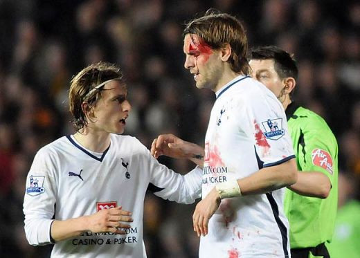 Ei chiar si-au dat sangele pentru fotbal! Vezi cei mai RUPTI jucatori din Anglia_10