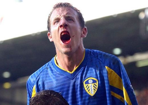 Ei chiar si-au dat sangele pentru fotbal! Vezi cei mai RUPTI jucatori din Anglia_12