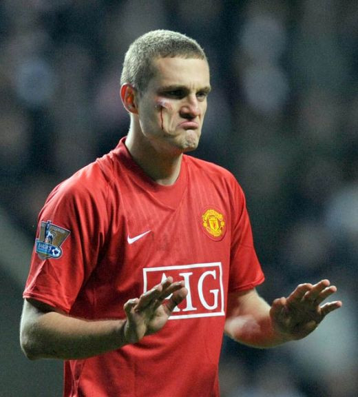 Ei chiar si-au dat sangele pentru fotbal! Vezi cei mai RUPTI jucatori din Anglia_13