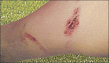 FOTO / Fabregas il acuza pe Adebayor: 