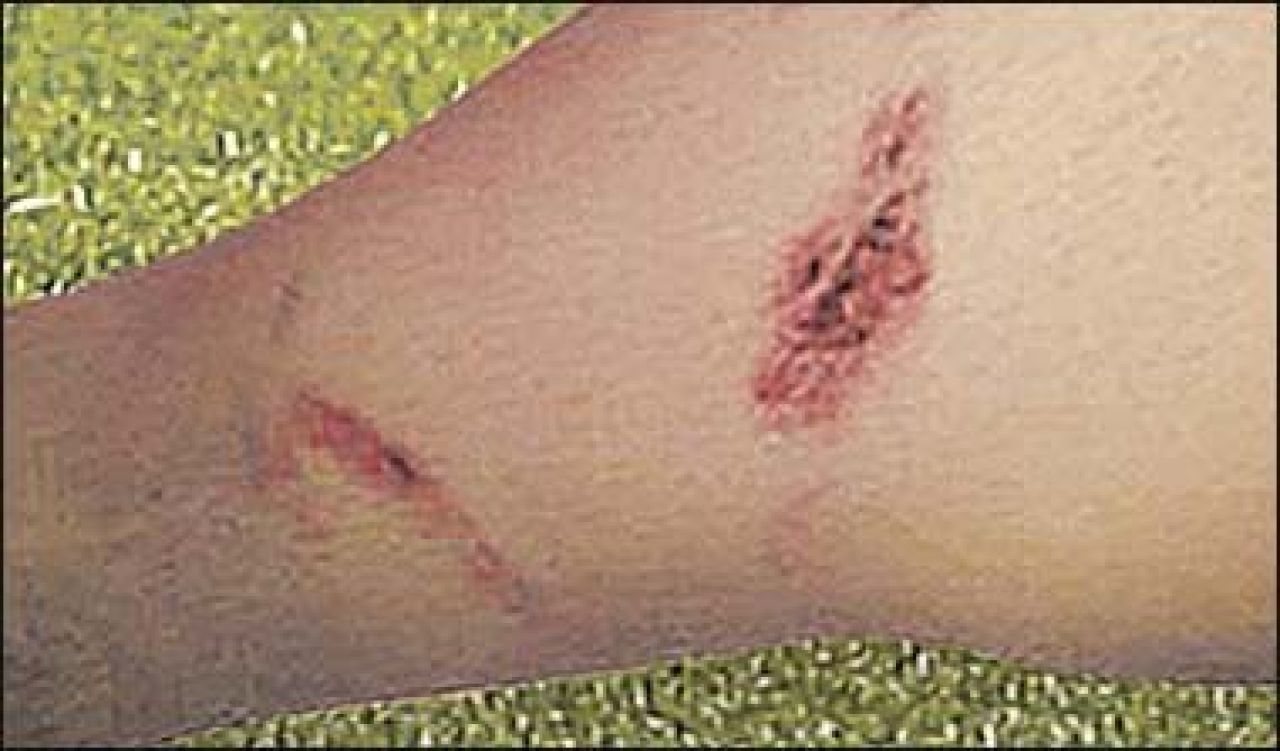 FOTO / Fabregas il acuza pe Adebayor: