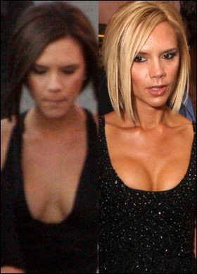 Alarma in Anglia! Ce s-a intamplat cu sanii Victoriei Beckham?