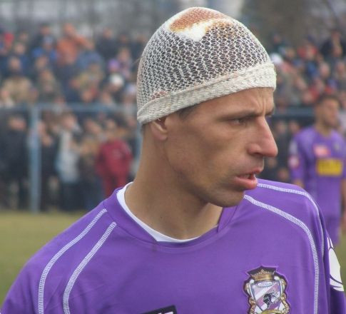 Badoi ca dupa razboi! A jucat tot meciul cu capul spart! Vezi imagini!