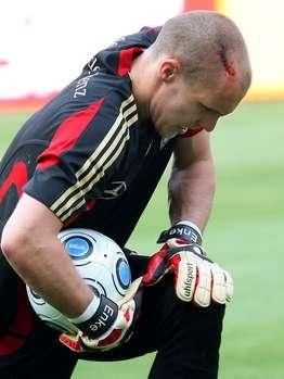 DRAMA: Enke, portarul nationalei Germaniei s-a SINUCIS! Cum a intrat el in istoria lui Dinamo  _46