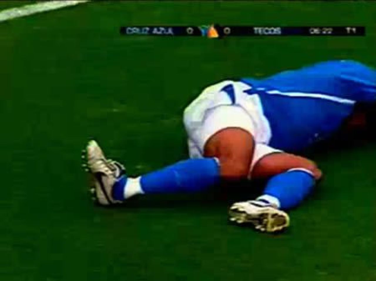 Cele mai GROAZNICE 12 accidentari din istoria fotbalului! VIDEO:_4