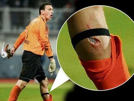 IMAGINI SOCANTE! Marica, martor la un accident teribil! Cum arata piciorul portarului lui Nurnberg!_2