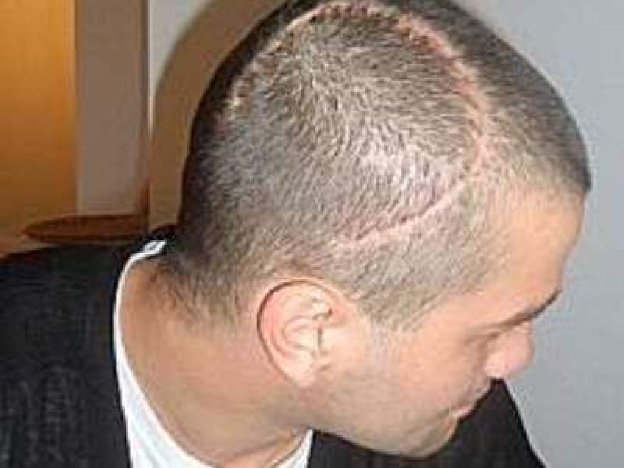 Doctorii l-au anuntat pe Chivu: