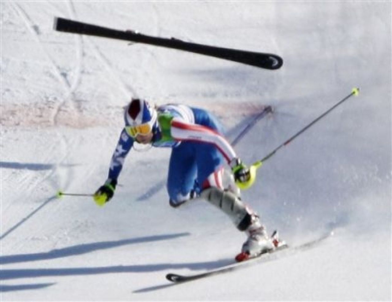 FOTO! Olimpiada ACCIDENTELOR! Vezi prin ce chin a trecut o campioana din America_6
