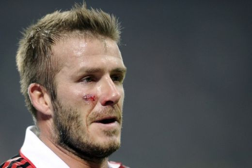 VIDEO Beckham, operat de urgenta in Finlanda! Poate rata Cupa Mondiala!_3