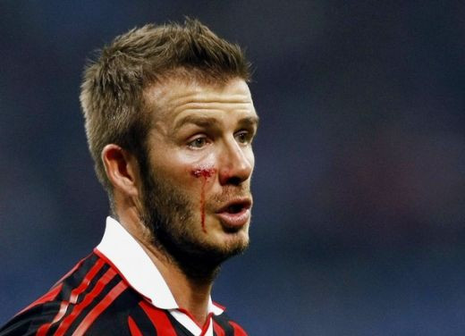 VIDEO Beckham, operat de urgenta in Finlanda! Poate rata Cupa Mondiala!_10