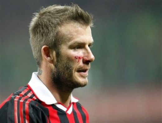 VIDEO Beckham, operat de urgenta in Finlanda! Poate rata Cupa Mondiala!_18