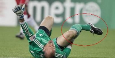 VIDEO Imagini-SOC! Dubla fractura de tibie si peroneu in MLS!