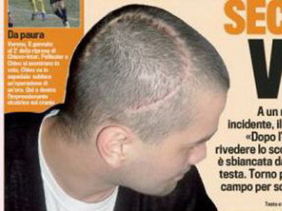 Chivu, a doua viata: M-am temut ca nu ma mai trezesc dupa operatie!