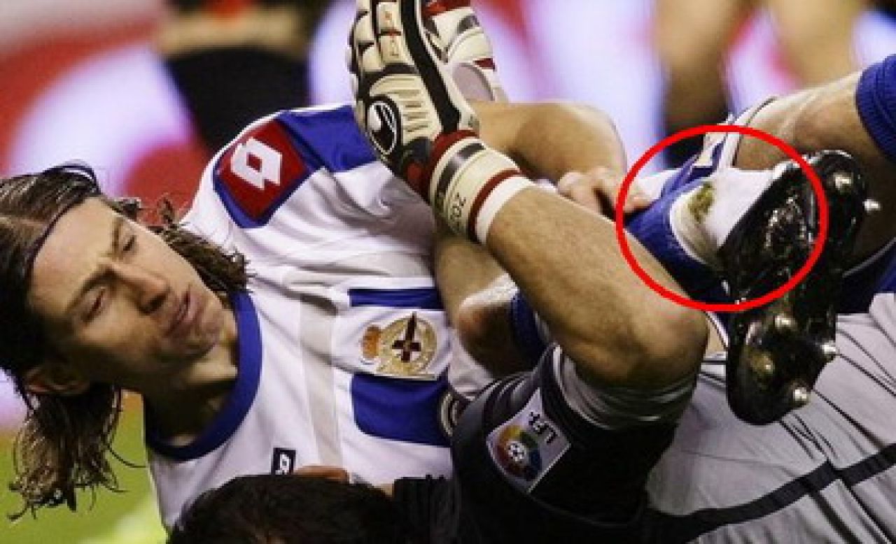 VIDEO HORROR: brazilianul Luis Filipe si-a DISTRUS piciorul pentru gol!_1