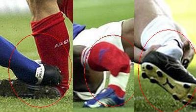 Cele mai GROAZNICE&nbsp;12 accidentari din istoria fotbalului! VIDEO: