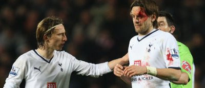 A dat gol si si-a spart capul! Woodgate a oferit imaginea serii in Anglia