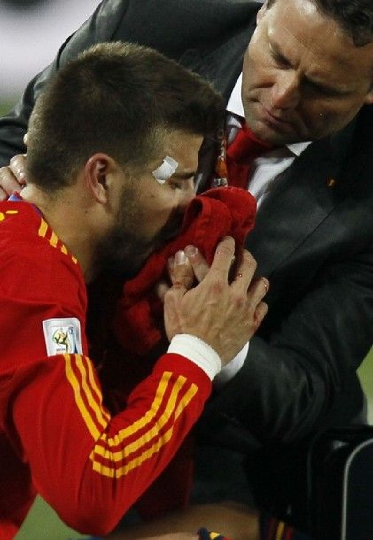 Pique arata ca dupa o runda cu Oscar de la Hoya: era sa-si piarda dintii!_1