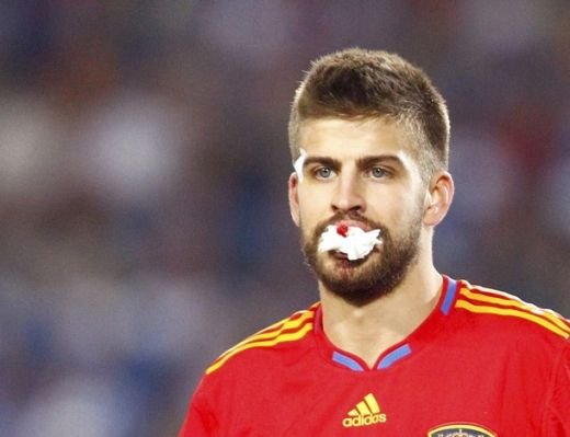 Pique arata ca dupa o runda cu Oscar de la Hoya: era sa-si piarda dintii!_3