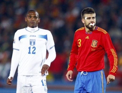 Pique arata ca dupa o runda cu Oscar de la Hoya: era sa-si piarda dintii!_4