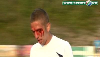 VIDEO Dinamo - U Cluj s-a lasat cu sange! Balaj a eliminat doi jucatori pentru bataie!
