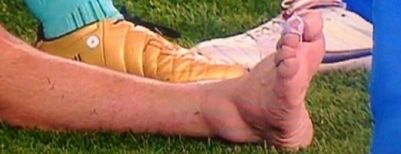 FOTO GROAZNIC! Cum arata piciorul lui Messi dus la spital dupa Atletico! Vezi ce au declarat medicii!_2