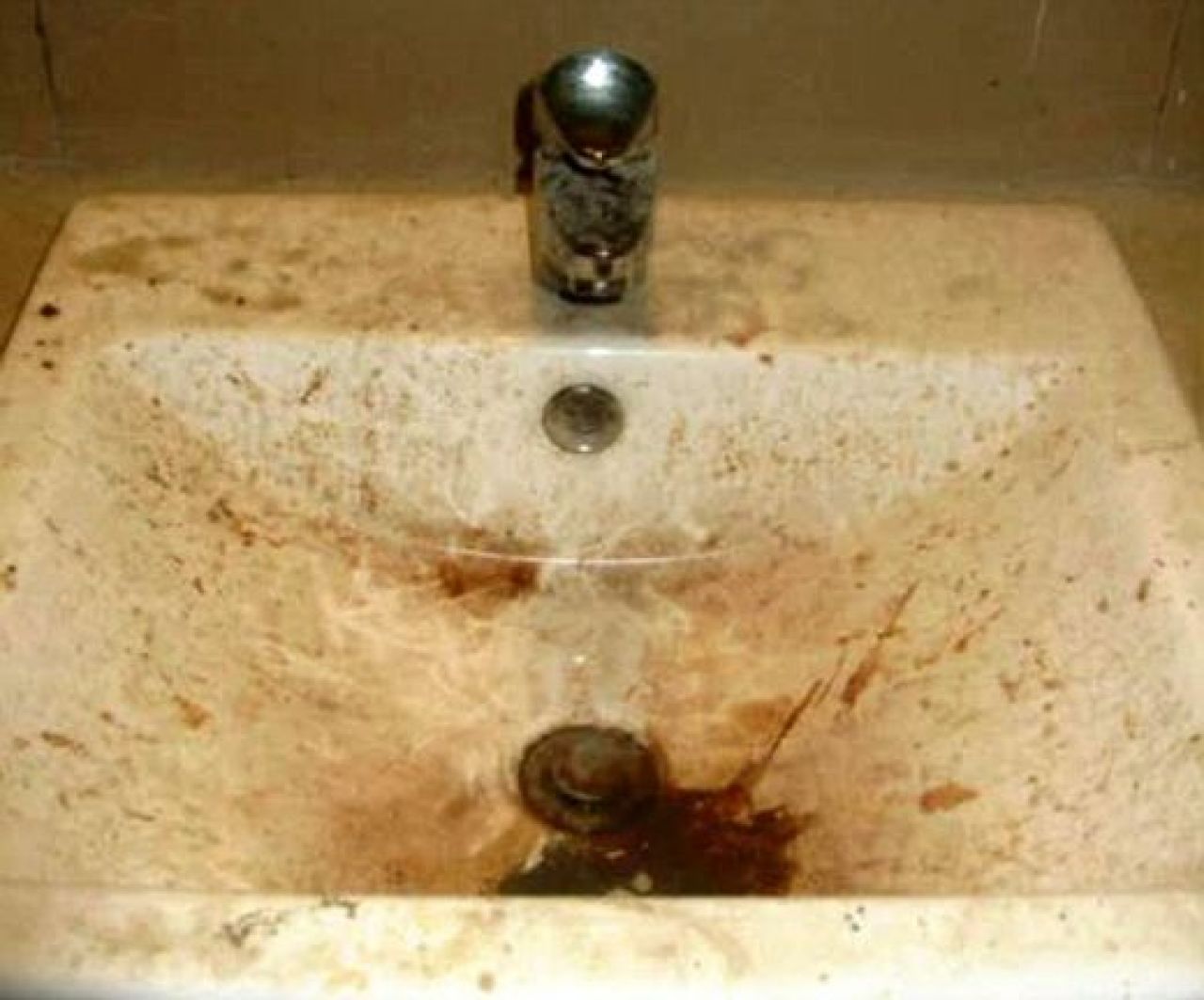 HORROR! Focar de infectie pentru sportivi! Conditii groaznice la Jocurile Commonwealthului!_2