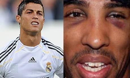 Cristiano Ronaldo AMENINTAT ca va fi DESFIGURAT azi! Vezi de ce!