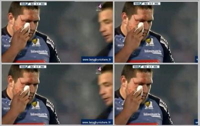 Un rugbyst roman a fost&nbsp;CALCAT pe fata de un adversar! VIDEO