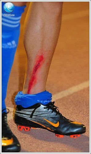 Radoi a INCASAT-O de la arabi - a fost victima unei intrari CRIMINALE! Vezi ce putea sa pateasca_6