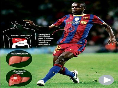 Va juca meciul VIETII: Abidal se opereaza joi! Vezi gestul la sacrificiu al fundasului in meciul cu Sevilla!