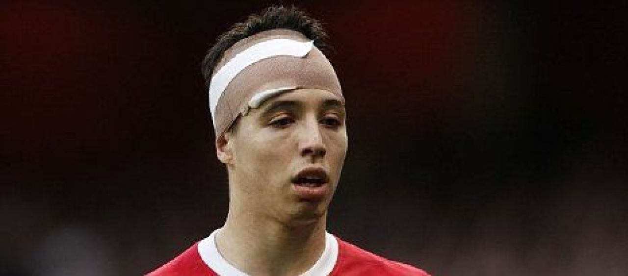 FOTO: Nici in MMA nu vezi asa umflaturi! Nasri a fost facut KO cu Blackburn!_2
