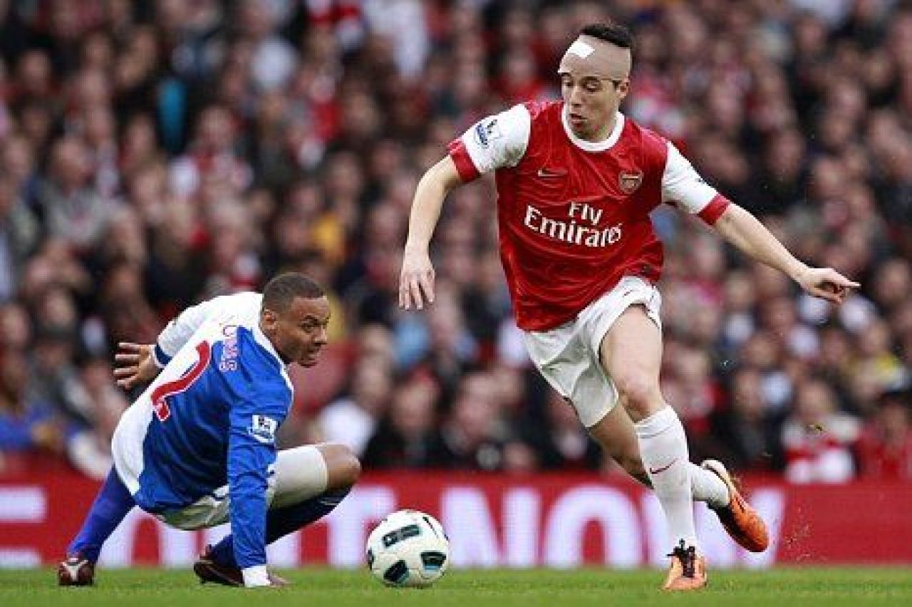 FOTO: Nici in MMA nu vezi asa umflaturi! Nasri a fost facut KO cu Blackburn!_6