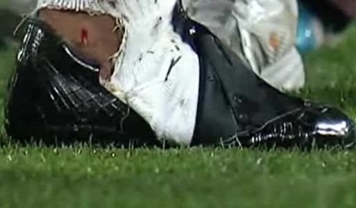 Fotbalul lasa urme adanci! Un roman a intrat in topul HORROR din fotbal! Cine e jucatorul care a ingrozit planeta!_14