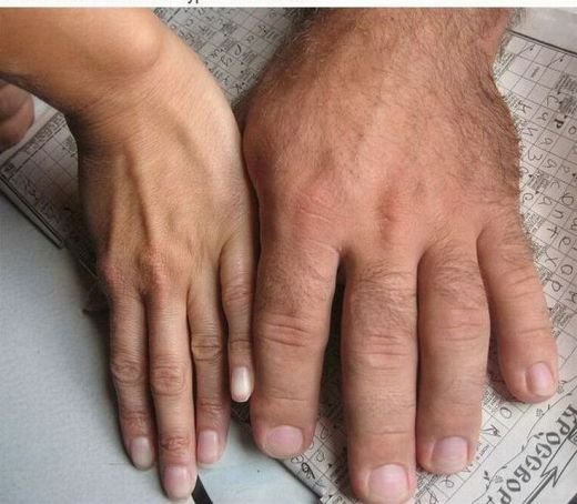 FOTO INCREDIBIL! Skandenberg-ul l-a DEFORMAT! Care e diferenta dintre mana unui om normal si a unui luptator