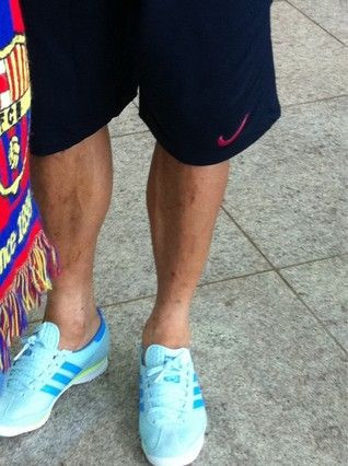 Urma intrarii criminale a lui Pepe e si acum pe picioarele lui Alves! Cum le inchide gura brazilianul celor de la Real!