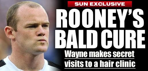 SECRETUL lui Rooney a fost DESCOPERIT! L-au prins in timp ce-si facea implanturi!