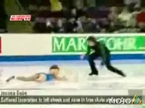 O secunda de neatentie a lasat-o desfigurata! O accidentare care iti va rupe inima :(