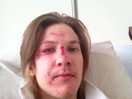 VIDEO HORROR! Accident ingrozitor la cel mai mare turneu de sarituri cu schiurile din lume! Vezi cum arata acum fata saritorului