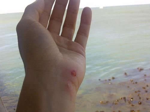FOTO: Shakira si Pique, la un pas de tragedii! Masina jucatorului Barcei, lovita de un autobuz! Cantareata, muscata de un leu de mare!_3