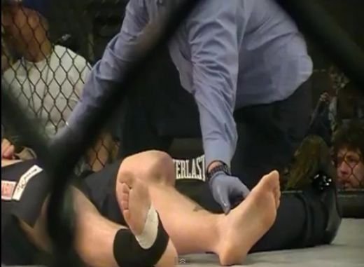 Accidentare HORROR in MMA: Nu te uita la imaginile astea daca abia ai terminat de mancat! VIDEO
