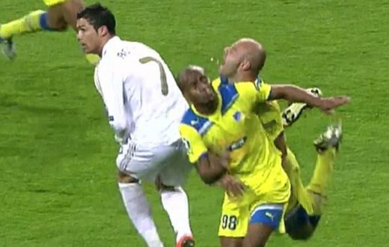 Zana Maseluta ii cauta dintii pe Bernabeu: Unul l-a pierdut, al doilea si l-a scos singur! SUPER FOTO:_4