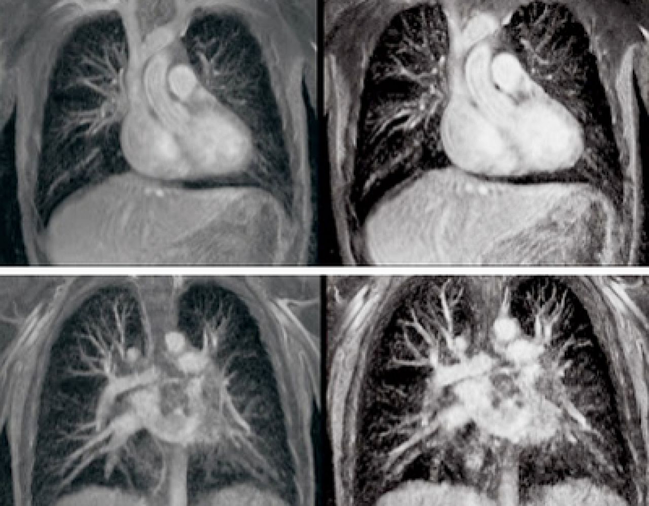 Descoperire FABULOSA in medicina! Primul om care traieste FARA INIMA! Vezi minunea care il tine in viata la 55 de ani: NU e niciun trucaj, am intrat intr-o noua ERA!_1