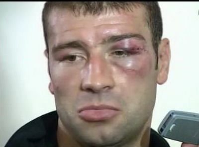VIDEO: Primele IMAGINI cu Bute dupa meci! Cum arata dupa primul KO primit in cariera! Mesajul lui Bute pentru romani: