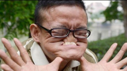 OFICIAL: El e cel mai urat om din lume! Cum poti castiga 15.000 de dolari cand te uiti in oglinda :)