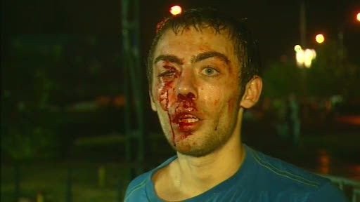 Imagini SOCANTE! Un suporter a vazut MOARTEA cu ochii la Vaslui! A fost DESFIGURAT de galeria Stelei in FATA stadionului!