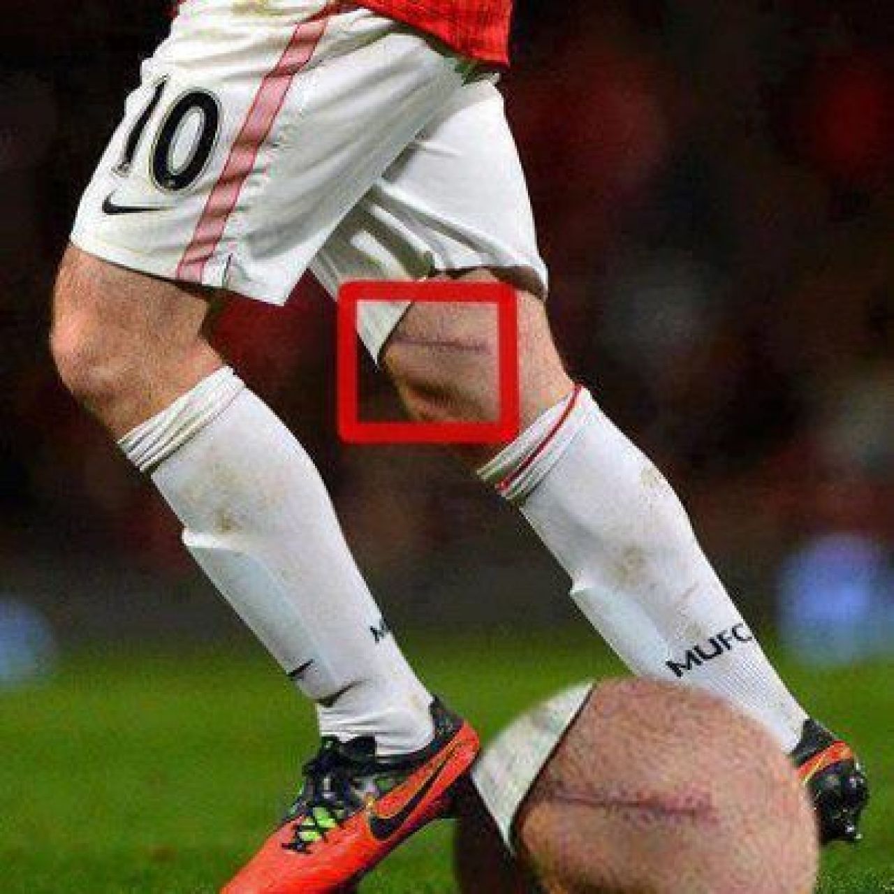 Rooney revine dupa accidentarea HORROR: I-a luat fix o luna! Un roman a murit ca fotbalist dupa 2 ani prin spitale: FOTO_1