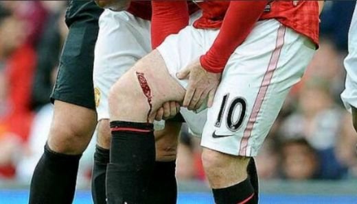 Rooney revine dupa accidentarea HORROR: I-a luat fix o luna! Un roman a murit ca fotbalist dupa 2 ani prin spitale: FOTO_3